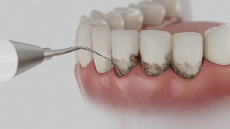 Reliable Dental Implants contractor in McClain County County, OK by Dentist Open Now